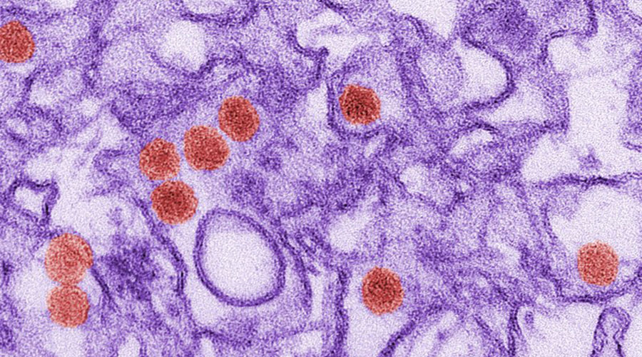 Study finds little bang for the buck in Zika blood testing