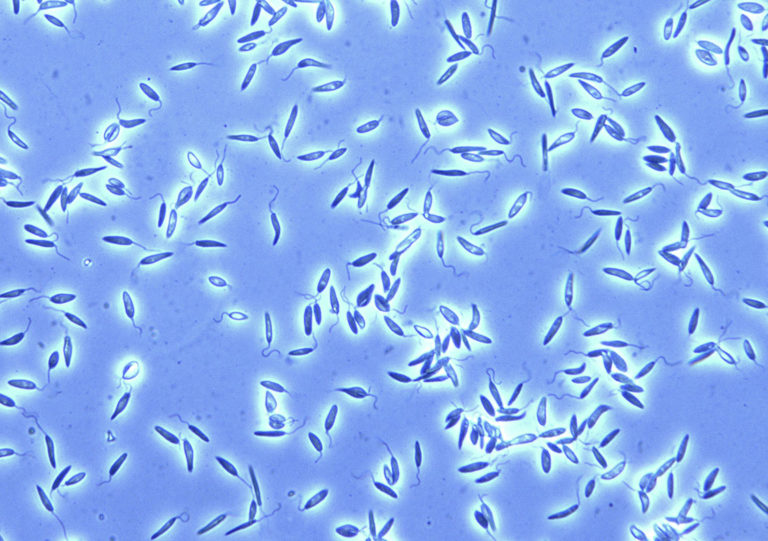 How to know if you have intestinal parasites