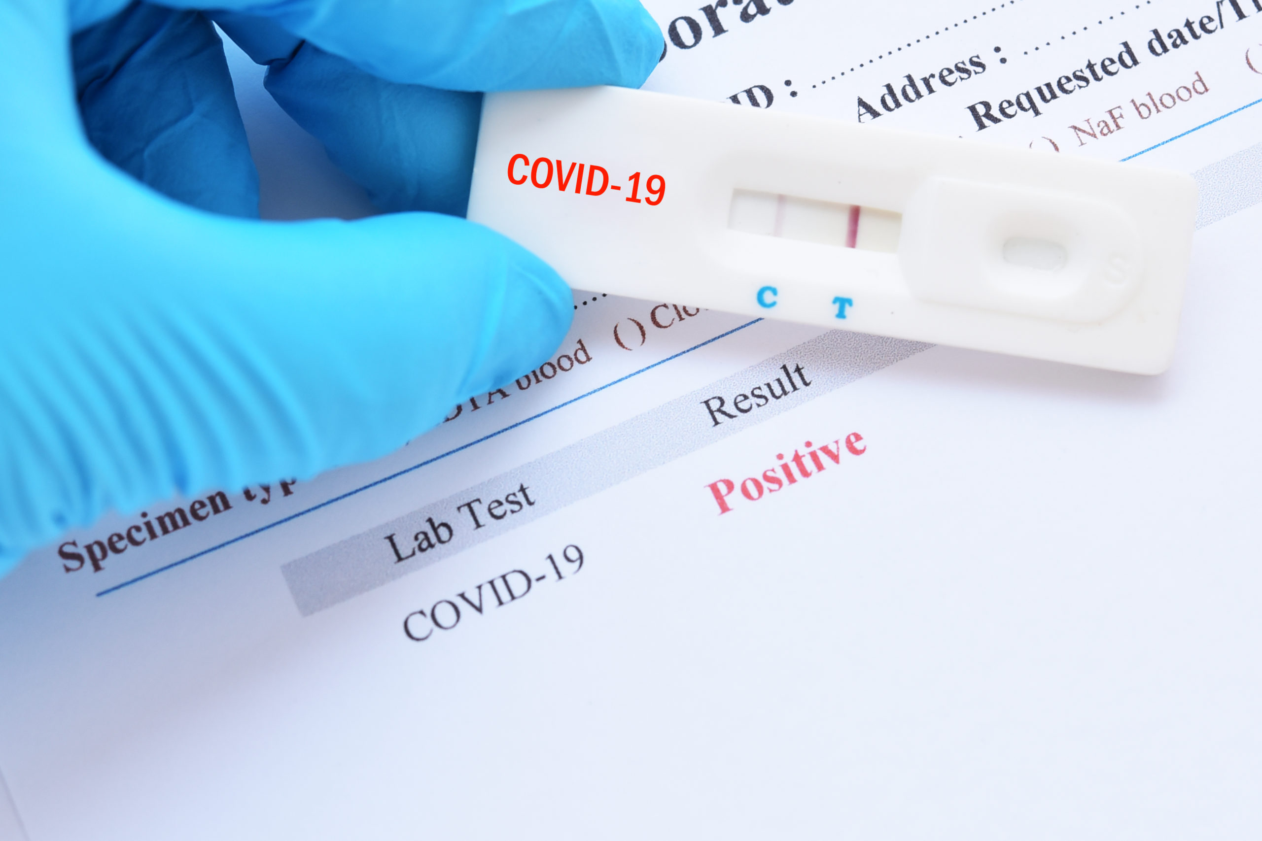 Covid Test / Texas coronavirus tests: Capacity remains limited, but ... : Types of testing • how can i get tested?