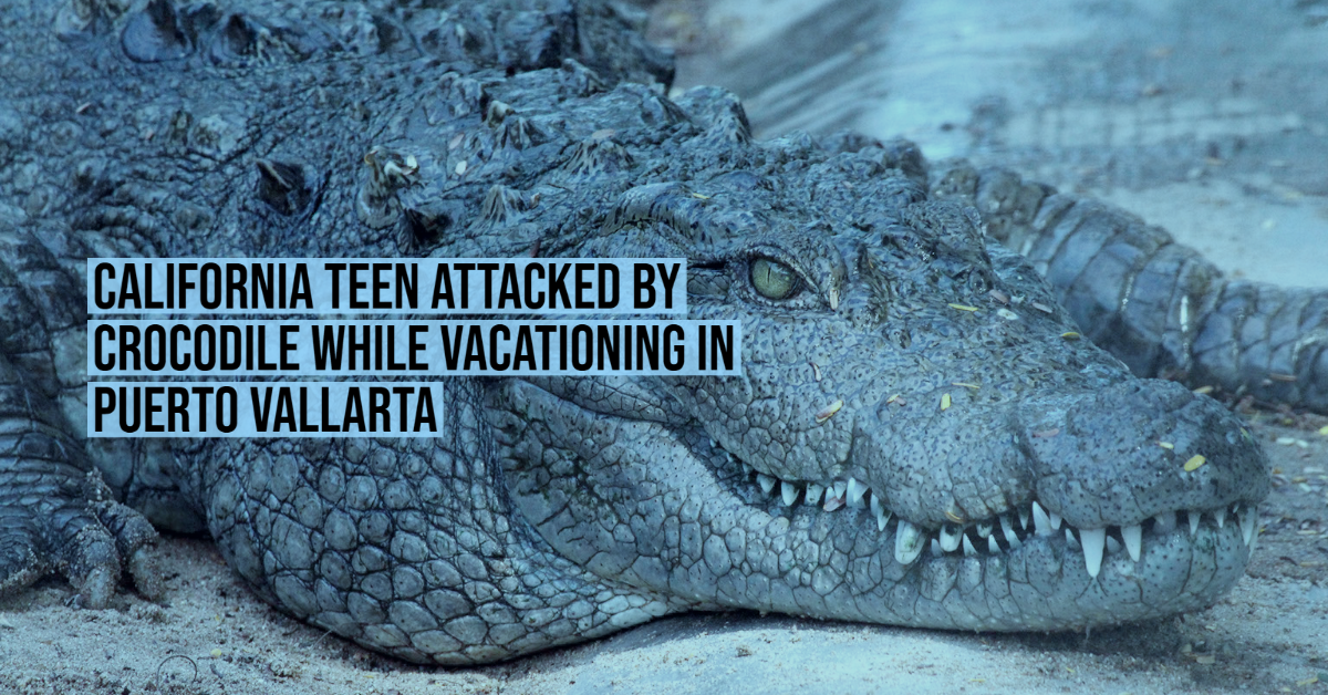 California teen attacked by crocodile while vacationing in Puerto Vallarta