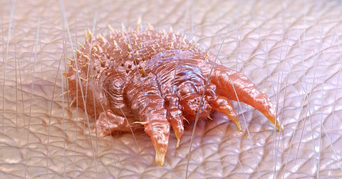 Chiapas scabies cases